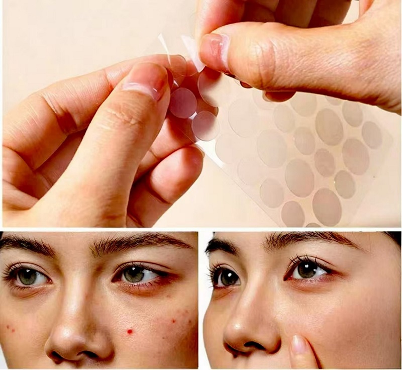 Hur man använder CmallBio Pimple Patches över natten för maximala resultat?